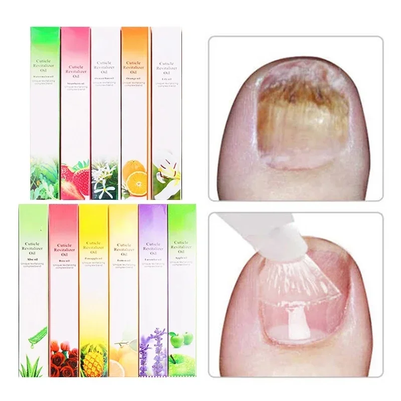 6PCS Penna per olio per cutico - Cuticle Oil Pen recensione e prezzo